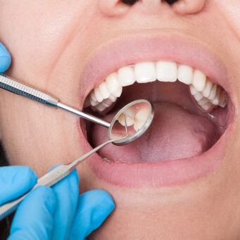 Dental Care