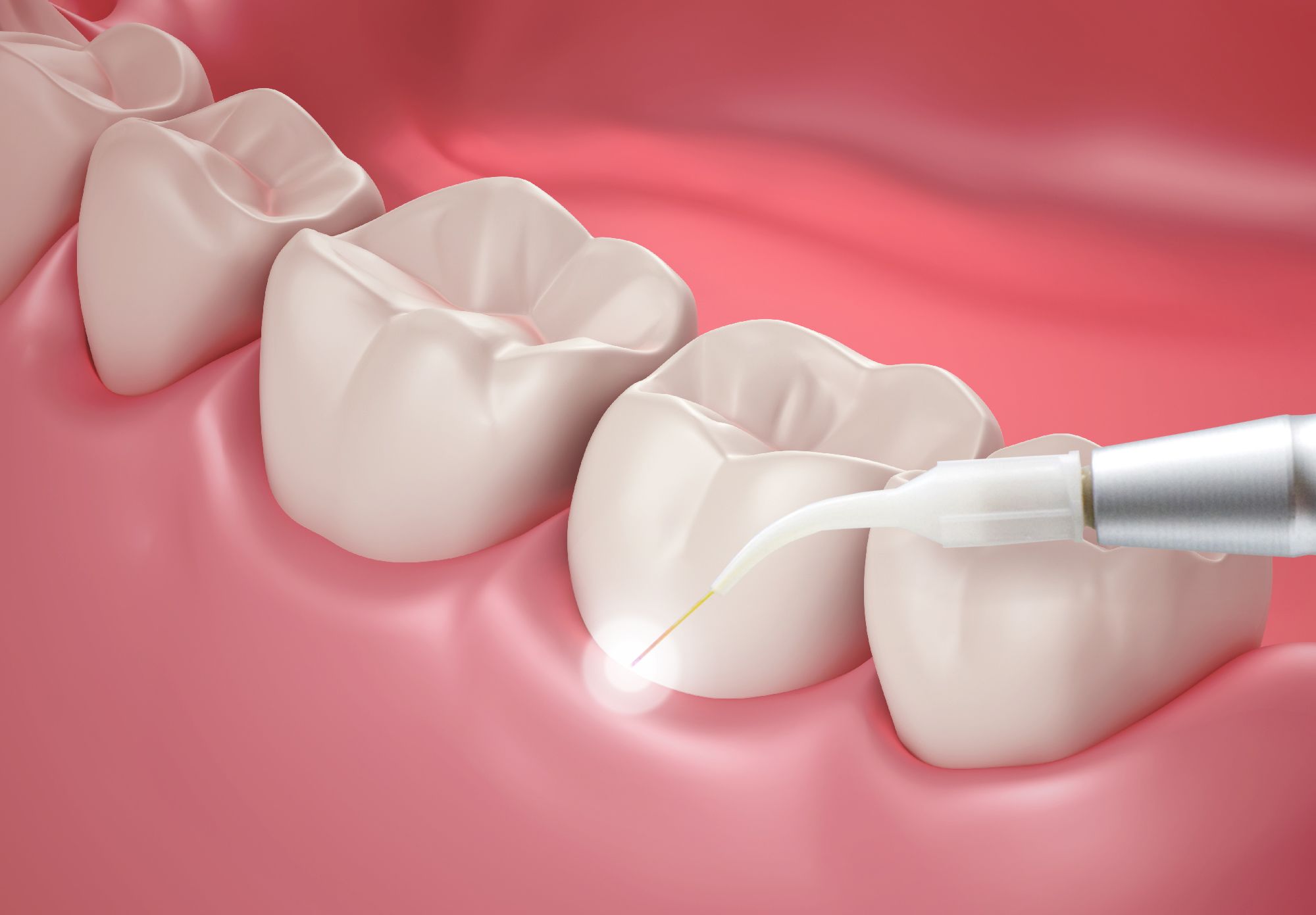 Periodontal graphic