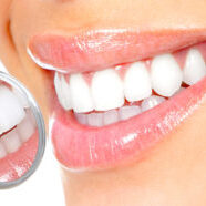 tooth whitening